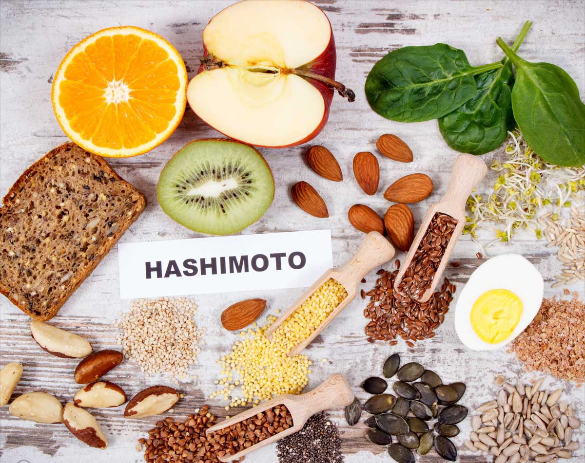 The Role of Diet in Hashimoto’s Thyroiditis Treatment